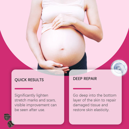 EELHOE® SilkBelly™ [Fast-Absorbing Recovery Oil for Moms]